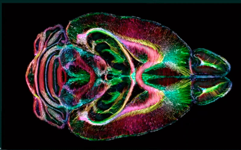 Необычное путешествие внутрь мозга: новая технология МРТ показывает детали, которых не видел никто раньше, в 64 миллиона раз точнее