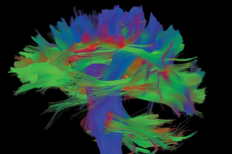 ИИ нашёл по МРТ ранее неизвестные изменения в мозге спортсменов