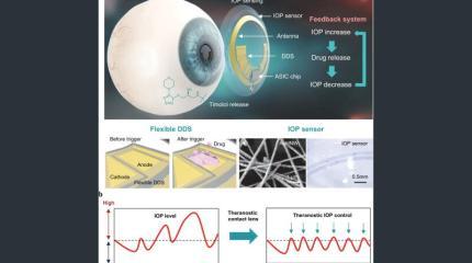 Умные контактные линзы контролируют и лечат глаукому