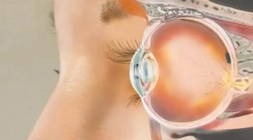 В США готовятся испытать на людях глазной имплант Science Eye