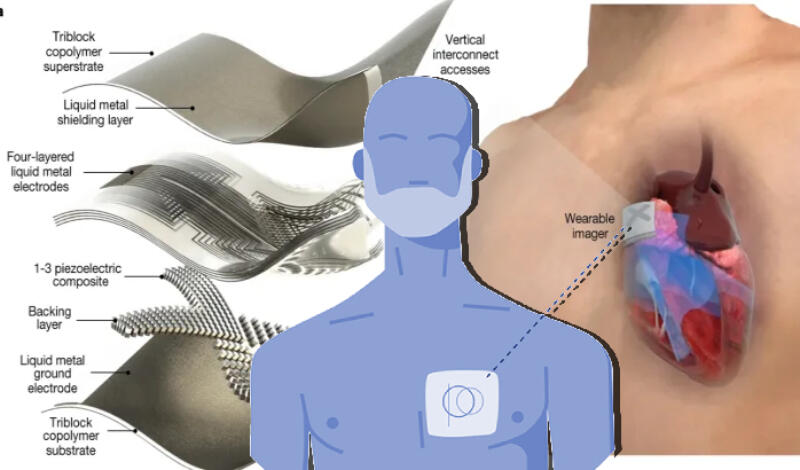 Ультразвуковой пластырь может предложить сканирование сердца в режиме реального времени