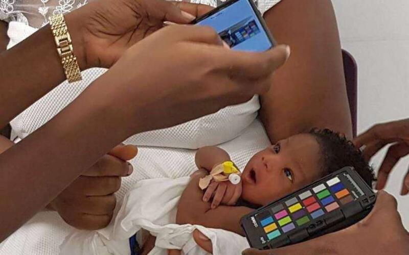Анемию у младенцев научились выявлять с помощью смартфона