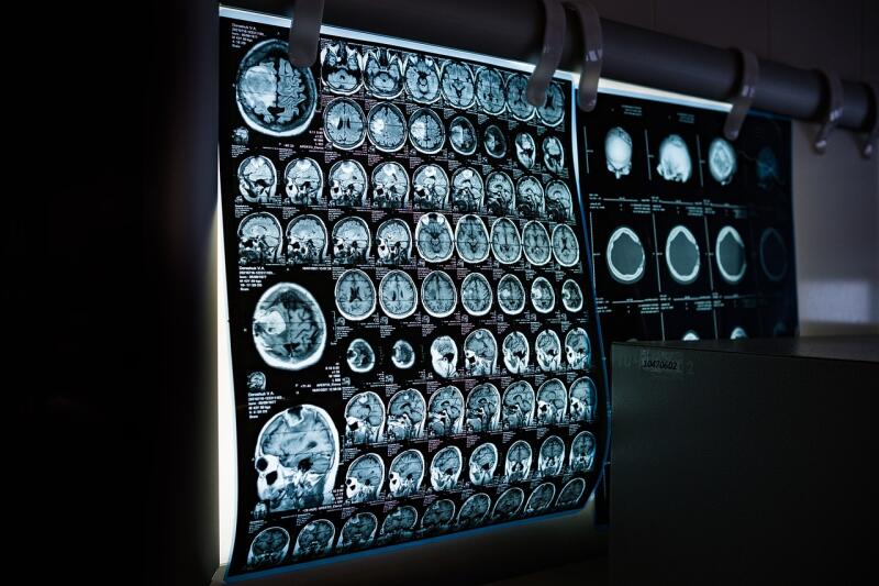В Британии собирают крупнейший банк сканов человеческих органов