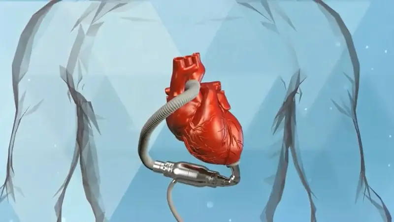 Российские ученые создали нанопокрытие, которое защищает сердце от тромбов