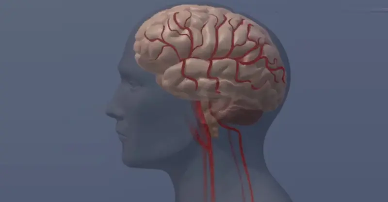 Ученые выяснили, как последствия психоза распространяются по мозгу