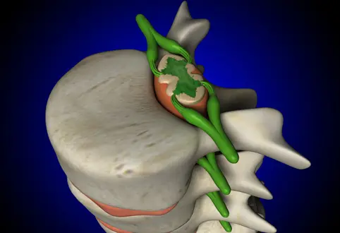 Восстановление спинного мозга после травмы возможно, утверждают ученые