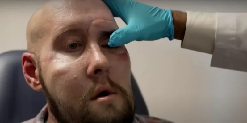 Впервые в мире человеку пересадили глаз