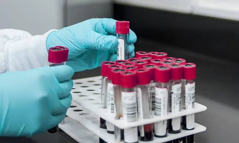 Учёные изобрели единый экспресс-тест на ВИЧ и туберкулёз