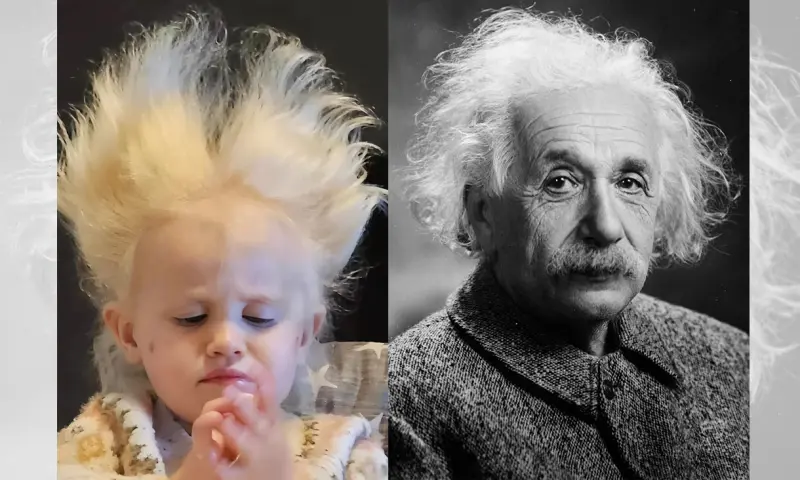 Слишком непослушные: редкое заболевание сделало ребёнка похожим на Эйнштейна