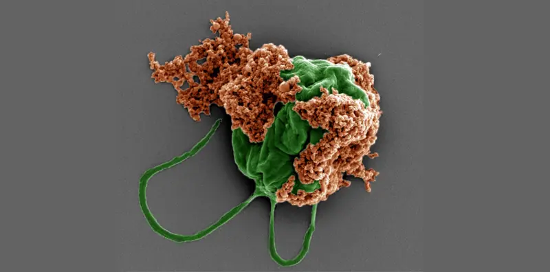 Микророботы из водорослей доставили лекарства прямо к опухолям в лёгких