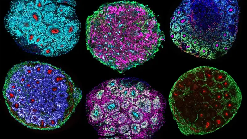 Ученые только что вырастили первый в истории «мини-мозг» из клеток нескольких людей