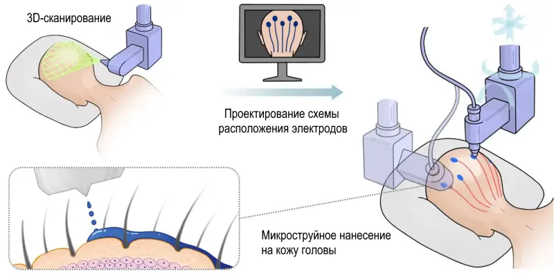 Жидкие электроды для слежки за мозгом обогнали нейрочип Маска