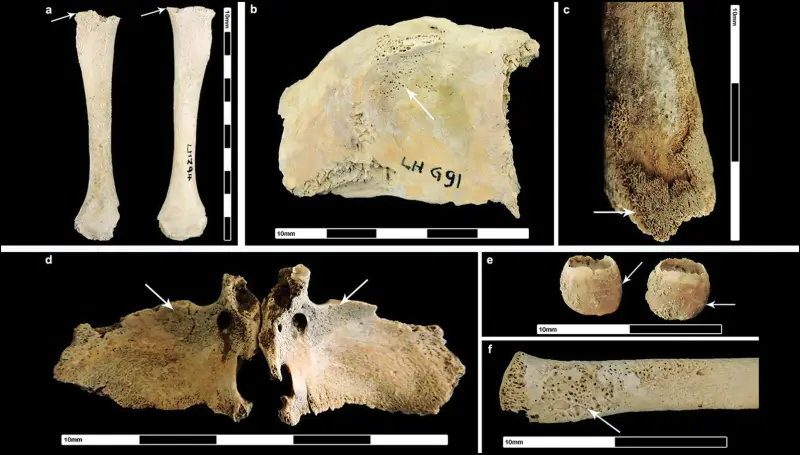 Темная сторона Рима: выяснилось, что Империя веками «выкачивала» здоровье из покоренных народов
