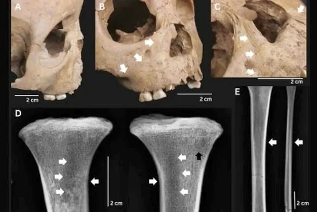 Колумба могут оправдать… древние детские кости из Юго-Восточной Азии?